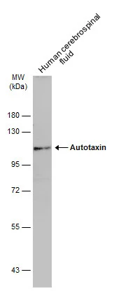Autotaxin antibody